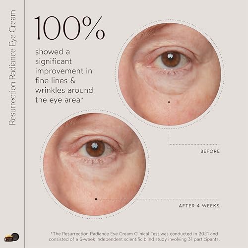 True Botanicals Resurrection Radiance Brightening Eye Cream | Reduces Appearance of Dark Circles, Fine Lines, Wrinkles & Puffiness | Dermatologist Tested, All Natural, Vegan| 0.5 oz | 15 ml