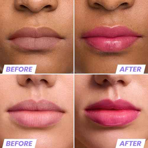 Wonderskin Lip Rehab Serum Oil (Kissed (2 Pack))