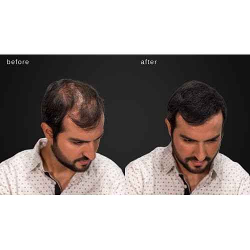 LUXE Hair Building Fibers - Thickening Fibers - CONFIDENCE IN A JAR ? 2 Months+ Supply! ? Hypoallergenic, Dermatologist Tested ? Multiple Colors Available (Dark Brown)