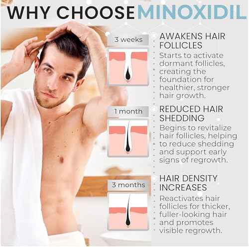 Remixidil Men¡¯s 5% Minoxidil Foam | Hair Regrowth Treatment for Men | Clinically Proven Formula for Hair Loss and Hair Growth | No Scalp Irritation | 3-Month Supply