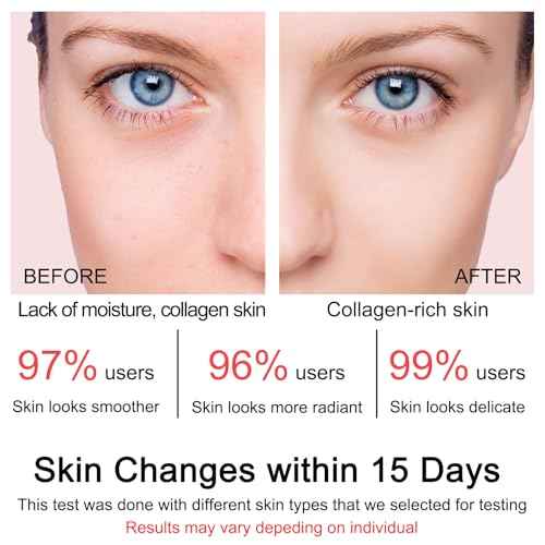 Collagen Jelly Cream - Contains Niacinamide & Freeze Dried Hydrolyzed Collagen -Elasticity & Hydration - Reduce Fine Lines & Dullness - Korean Glass-Shiny Skin Suitable for All Skin Types (3.38 Fl.Oz)