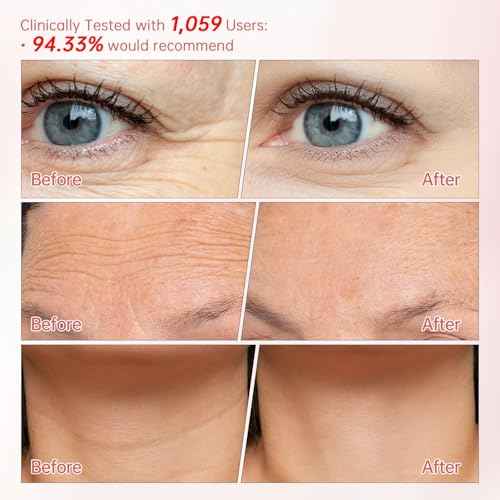 Peunitory Eye Balm Stick,Under Eye Cream Anti-Wrinkle Firming Treatment | Dark Circle Brightener | Hydrating (0.32oz)