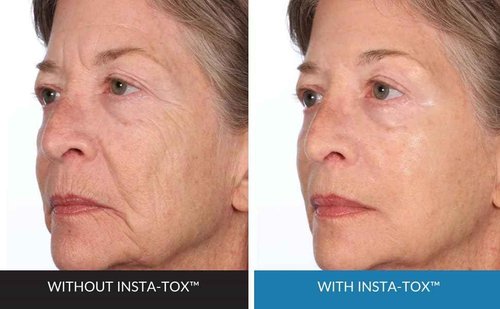 INSTA-TOX Facial Firming Wrinkle Smoothing Serum & Reverse Lift Firming Eye Cream Set - Tightener for Lines, Deep Wrinkles and Pores - Temporary Lift for Face and Eyes - Serious Skincare