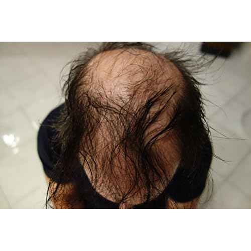 Finally Hair Keratin Hair Building Fibers for Hair Thickening Fiber Hair Loss Concealer. (Light Grey & Pepper)