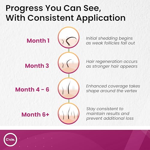 Minoxidil for Women 5% Foam - Helps Restore Top of Scalp Hair Loss and Support Hair Growth for Women, Regrowth with Unscented Topical Treatment for Thinning Hair (5% Foam 8-Month Supply)