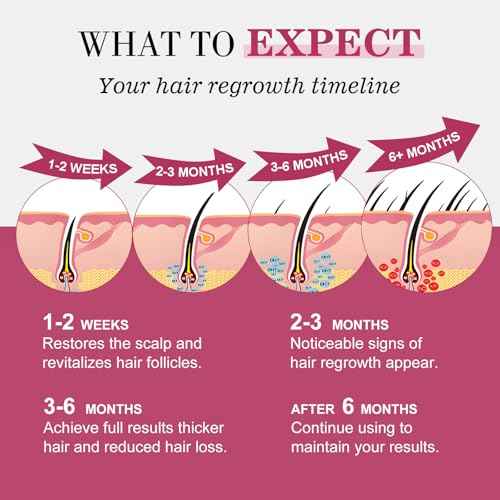 5% Minoxidil for Women Hair Regrowth Spray, hers hair regrowth treatment Infused with Biotin, Extra Strength Treatment to Combat Hair Loss and Thinning, 6 Bottles£¨100 Ml)