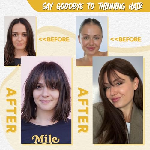 10inch Hair Toppers for Women Clip in Bangs with Thinning Hair Pieces for Women Medium Brown Hairr Topper for Woman 4.4 * 3.1¡¯ Wiglets Hairpieces for Thinning Hairs#4