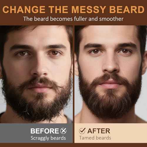 XIKEZAN 5 Pack Beard Oil Set w/Sandalwood, Orange, Vanilla, Cedarwood, Unscented for Beard Care, Moisturizing, Soften,Birthday Gifts for Men Him Dad Husband Christmas Gifts Stocking Stuffers
