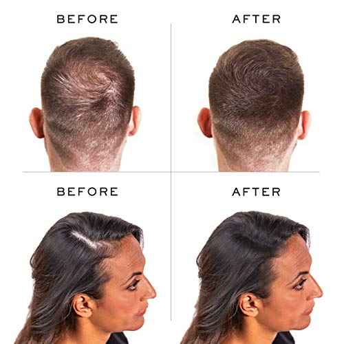 Nanogen Keratin Hair Fibers,, 30-grams, Light Brown