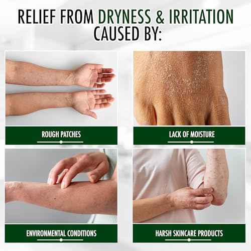GLY MIRACLE Moisturizing Body Cream Lotion, 16 ounce - Non-Greasy Skin Humectant for Extremely Dry Skin, Hands, Body, and Feet, Fragrance-Free with Pure Glycerin for Nourishing Hydration.