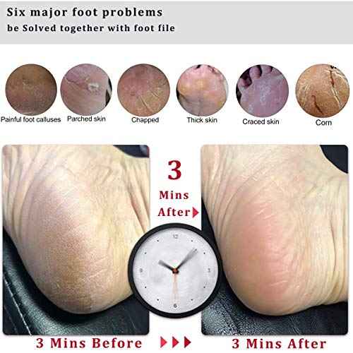 Foot File Callus Remover Foot Scrubber,Professional Pedicure Foot Rasp Removes Cracked Heels,Dead Skin,Corn,Hard Skin,Pumice Stone for Scraper File Brush Tools for Wet and Dry Feet
