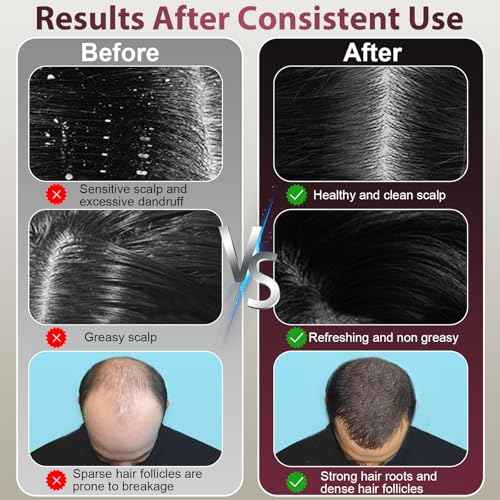 Laser Therapy Hair Growth Comb, Hair Oil Applicator,Electric Scalp Massager Hair Growth with IPX7 Waterproof