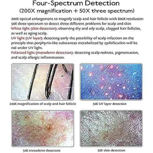 Skin Hair Scalp Detector Analyzer,15inch LCD Screen Digital Skin Detector, Multifunctional Scalp Detector Machine, Rechargeable Hair Follicle Skin Analyser Machine
