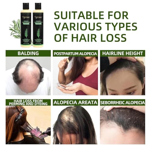 Tgideas Organic Rosemary Hair Growth Shampoo for Women and Men-Natural Thickening & Strengthening Shampoo with Hydrolyzed Keratin for Thinning Hair & Hair Loss 7.4 fl.oz