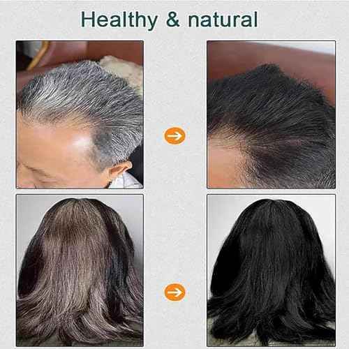 Qiweitang Hair Dye Shampoo, Vivping Zhihuashi Caviar Protein Hair Dye, 500ml Zhihuashi Hair Color Shampoo Korean, Plant-Based Hair Coloring Cream for Gray Hair Coverage (Chestnut brown)