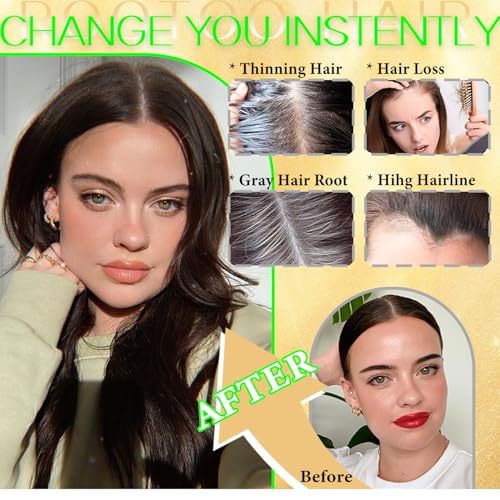 Rootoo Hair Toppers for Women Real Human Hair, 16 Inch Realistic Biological Scalp Topper Hair Pieces for Women with Thinning Crown with Middle Part Clip in Bangs Big Base 360¡Æ Cover (Dark Brown)