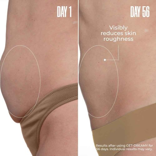MAËLYS GET-DREAMY Overnight Toning Whip - Body Firming Whip That Works While You Sleep - Helps Skin Look Tighter