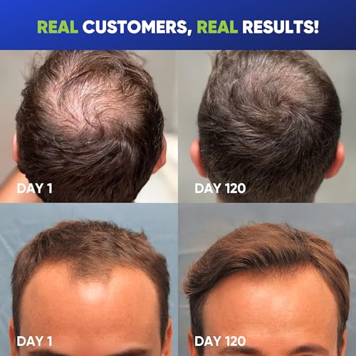 Svvimer Hair Growth Shampoo for Men - Biotin Thickening Shampoo with Rosemary Tea Tree Oil Caffeine for Hair Loss and Thinning - 13.5 Fl Oz (Pack of 1)