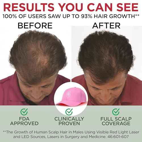 Red Light Therapy Hair Growth Cap ? FDA Cleared Laser Treatment for Hair Regrowth and Reduced Shedding ? LED & Laser Red Light Therapy Clinically Proven in Double-Blind Studies - Pink