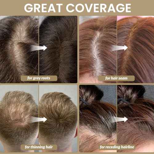 VOLLUCK Root Touch up Powder, Instant Hairline Powder for Thinning Areas and Gray Hair Coverage, Natural and Non-greasy Root Cover up for Women and Men (Dark Brown, 0.14 Ounce)