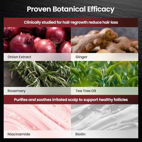 Onion & Biotin Hair Growth Shampoo: Infused With Natural Rosemary Tea Tree Oil Anti Hair Loss Shampoo - Scalp Smooths Thickening Formula Support Hair Regrowth For Women Men (12.5 Fl Oz)