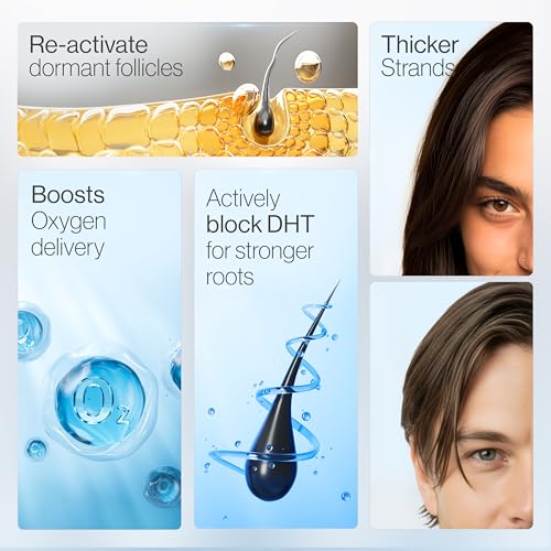 Be Bodywise Rosemary Hair Growth Serum Roll On 25 ml ? 3% Rosemary, 3% Redensyl & 2% Anagain | DHT-Blocking Scalp Serum Boosts Oxygen Flow, Reduces Hair Fall | Paraben/Sulfate-Free | Women & Men