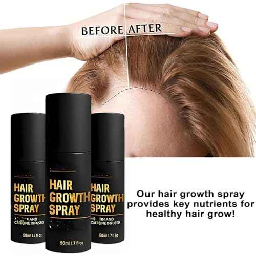 Hair Growth, Hair Growth Spray, Promotes Thicker, Fuller Hair For Women & Men ? All Hair Types, Hair Thickening Sprays With Natural Ingredients (1 PCS)