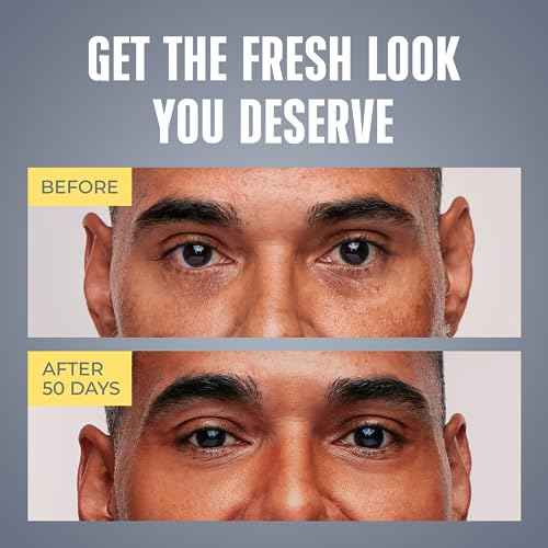 Mens Eye Cream - Eye Bags Treatment for Men & Wrinkle Reduction | Collagen, Vitamin B3, Peptides, 5% Caffeine ? Mens Under Eye Cream Bag Remover ? Puffy Eyes Treatment for Men
