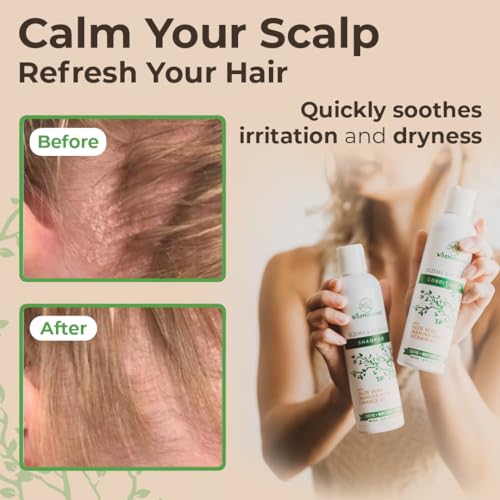 Anti-Dandruff & Seborrheic Dermatitis Treatment Shampoo & Conditioner Set for Men & Women - For Itchy, Dry Scalp and Hair with Psoriasis & Eczema