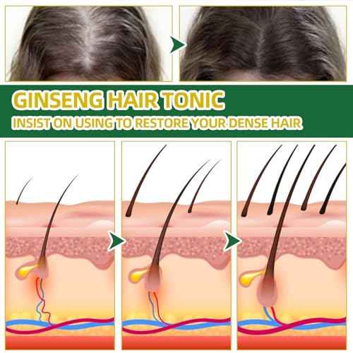 Hair Growth Spray, OUHOE Tonico Para Crecimiento Del Cabello, Natural Herbs Ginseng Hair Tonic, Generic Stronger and Hair Thickening, Non-greasy Nourishing Hair Mist for Women & Men (2Pcs)