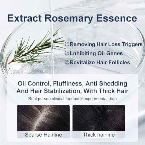 Tgideas Organic Biotin & Rosemary Hair Growth Shampoo ? Thickening Shampoo with Amino Acids for Hair Loss, Dandruff Control & Oily Scalp - for Women & Men