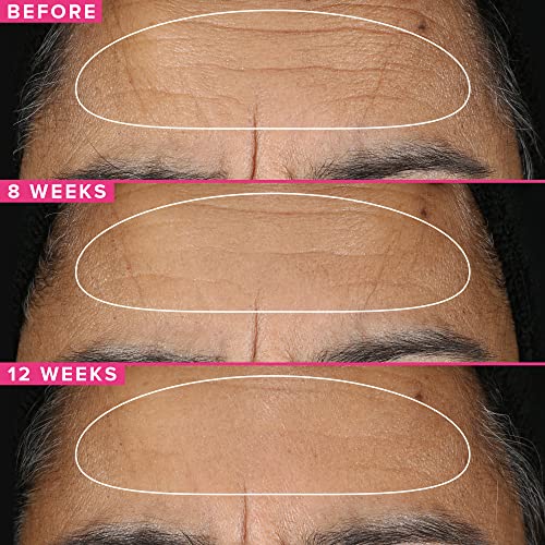Farmacy Retinol Serum for Face - 1% Vitamin A Anti Aging - Resurfacing Wrinkle Formulated with Encapsulated Retinol + Ceramide NP to Prevent Moisture Loss + Replenish Skin Barrier (30ml)