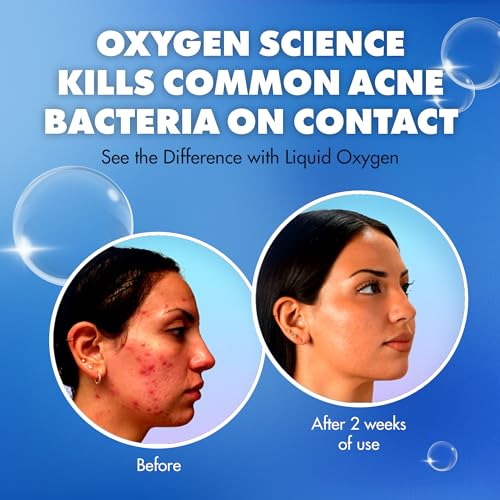 Liquid Oxygen Acne Treatment System for Acne-Prone Skin | Oxygen-Infused | Cleansing Wash, Blackhead Astringent & Hydrating Moisturizer | Blemish Control & Pimple Treatment | Dermatologist-Recommended