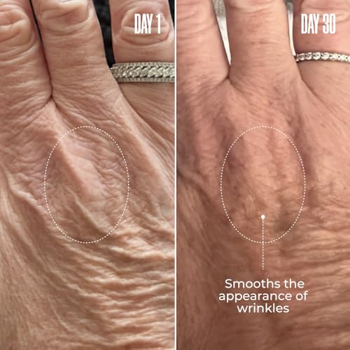 MA?LYS B-GLOSSY Smoothing Body Serum - Anti-Aging Hyaluronic Acid Serum for Body Wrinkles - Hydrating Serums with Peptides & Shea Butter To Smooth The Appearance Of Wrinkles