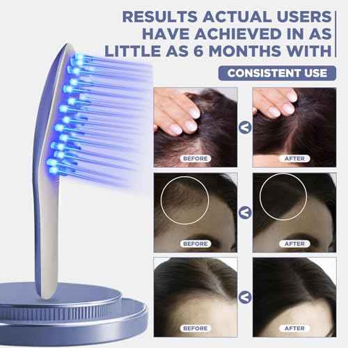 Laser Therapy Hair Growth Comb Model:Lasercomb-001, Hand-held Comb-Shaped Low Level Laser Therapy Device That emits Laser Light Designed to Promote Hair Growth in Women and Men.