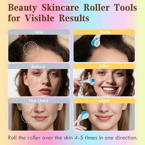 Derma Roller - TUMAKOU Microneedle Roller for Face Scalp Hair - Beard Roller for Women and Men