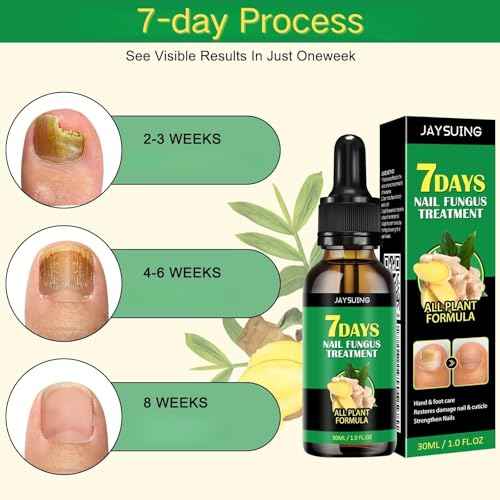 Ginger Nail Treatment Serum - Moisturize the Cuticle & Strengthen Nails and Helps Nails Healthy Grow, 1 fl.oz (Pack of 2)