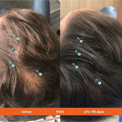 DS Labs Revita Shampoo & Conditioner Kit, 925mL ? Scalp First System for Fuller Looking, Volumized Hair, Lightweight Hydration, Sulfate & Silicone Free, Color Safe, For Men & Women