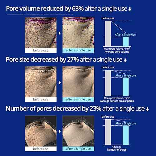 Saunan Heating Salt Mask - Top Finnish Sea Sauna Salt Mask for better skin. Healing dead skin cells and effective pore reducer. No more blackheads.(5.29 oz)