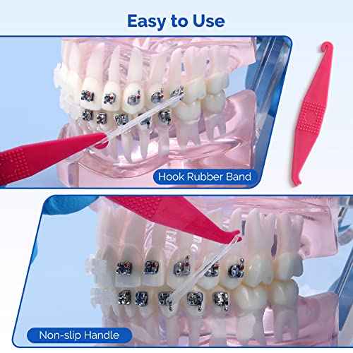 JMU Orthodontic Rubber Bands 1/4 Medium 6.4 mm Clear Orthodontic Elastics 4.5oz 500 pack Latex Free Dental Rubber Bands Made in USA