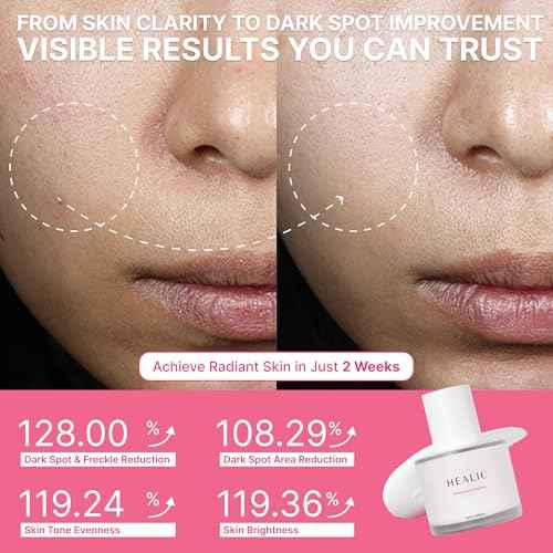 Toning Active Ampoule?Brightening, Hydrating&Soothing with Tranexamic Acid, Niacinamide&Hyaluronic Acid, Dark Spot Correction, Gentle for Sensitive Skin, Korean Skin Care, 50ml/1.69 fl.oz