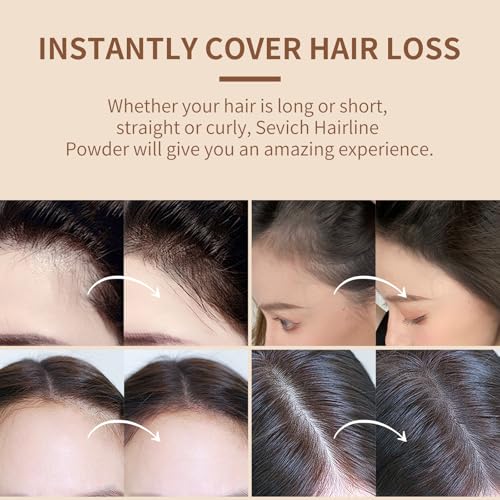 Sevich Hairline Powder,Instantly Conceals Hair Loss, Root Touch up Powder, Hair Shadow Toppers for Women & Men, Touch Up for Thinning Gray Hair, Windproof & Sweatproof,Medium brown