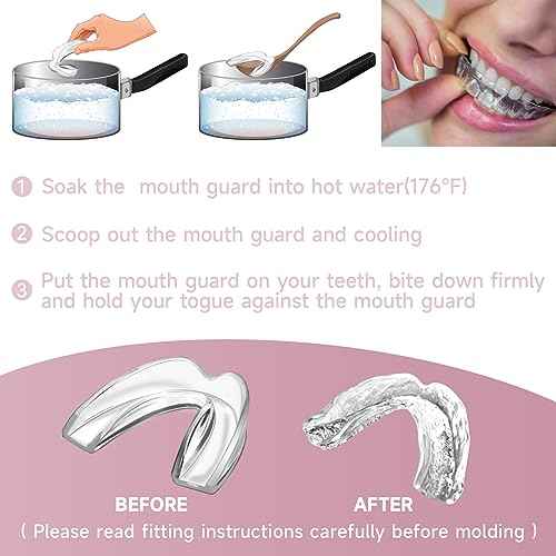 4 Pack Pink Mouth Guards for Women and Teens, Medium Size, Moldable Night Guards for Teeth Grinding and Clenching, Comfortable Bite Guards, Stylish Custom Dental Guards for Protection
