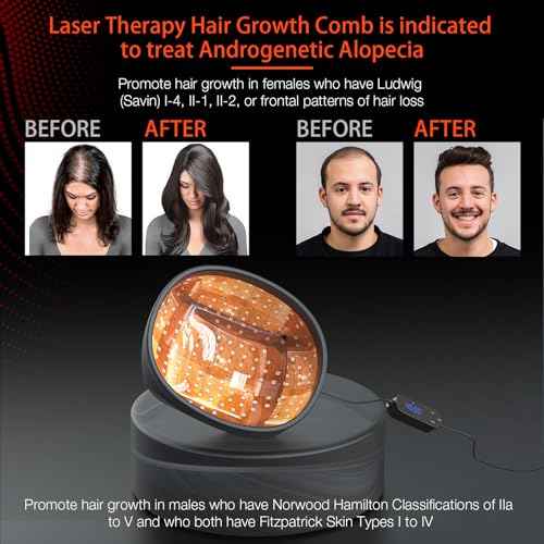Laser Cap (FDA Cleared), Professional Medical Grade Laser Hair Growth Treatment Product for Men & Women, Red Light Therapy for Hair Growth, Treat Alopecia