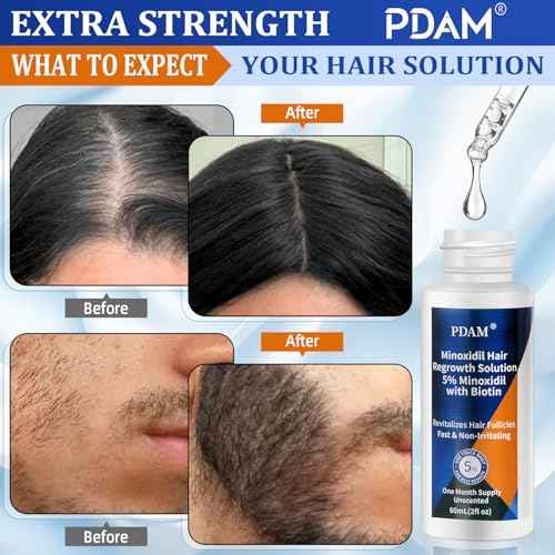 Minoxidil for Men and Women Hair Growth - 5% Minoxidil Hair Growth Serum for Men to Regrow Fuller, Thicker Hair & Beard - Minoxidil for Women Hair Growth- Improves Appearance of Thinning Hair 2 FL OZ