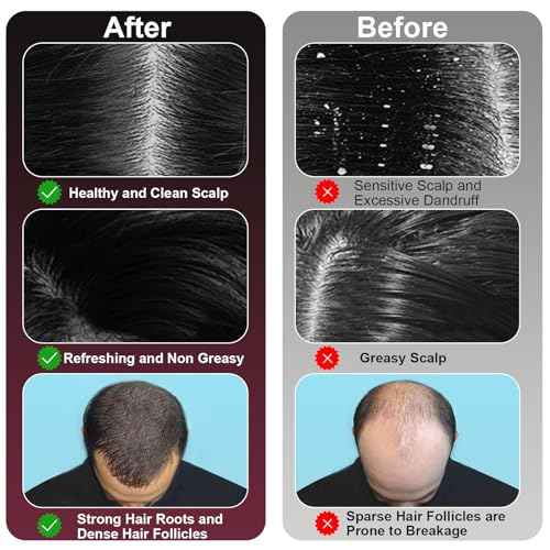 Laser Therapy Hair Growth Comb, 3 in 1 Hair Oil Applicator for Hair Care, 360¡Æ Electric Scalp Massager, Stimulates Hair Regrowth for Men & Women, IPX7 Waterproof