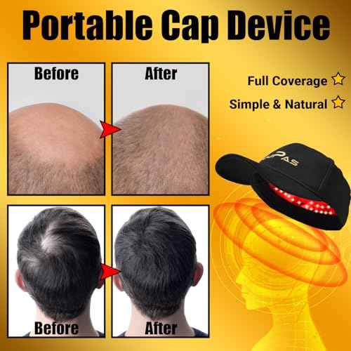 UUPAS Laser Hair Growth Cap