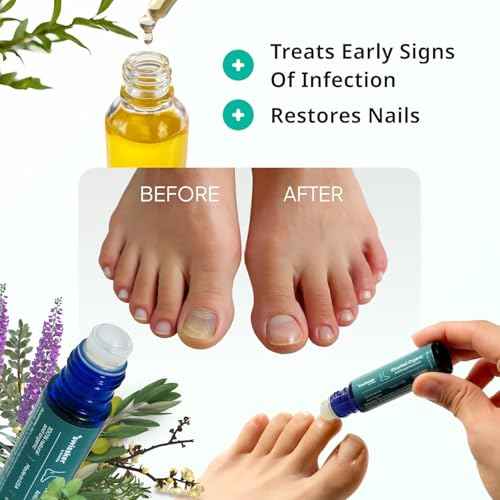 Swissklip Medi-Care Toenail Stick I KlearNail Treatment | Natural Solution for Healthy Nails I Suitable For Foot, Toe, and Fingernail I For Brittle Toenails ? 10ml / 0.3 Fl. Oz. Pack 2 - Made in USA