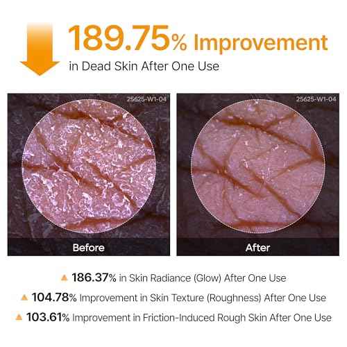 Dr.Melaxin Body Keratin Care Kojic Acid Turmeric Spray Gently Exfoliating Peeling Solution Korean Skincare All Skin Types 200ml