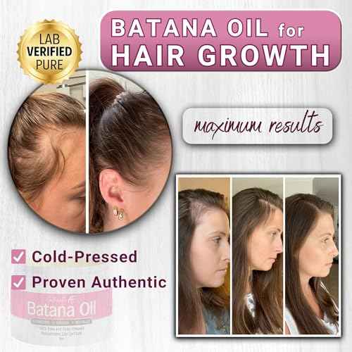Dr. Sebi Batana Oil for Hair Growth, 100% Pure Raw & Unrefined from Honduras, Aceite de Batana Hair Growth Oil for 4C Hair - Edges, Scalp, Length